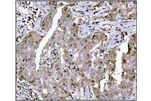 IHC analysis of KMT1B/SUV39H2 using anti-KMT1B/SUV39H2 antibody (ABIN7602135). (SUV39H2 antibody  (AA 6-410))