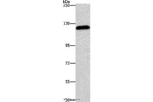 Western blot analysis of Hela cell, using AGAP2 Polyclonal Antibody at dilution of 1:700 (AGAP2 antibody)