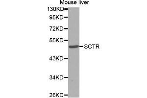Western Blotting (WB) image for anti-Secretin Receptor (SCTR) antibody (ABIN3017416) (SCTR antibody)