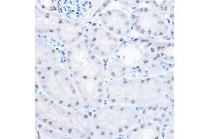 Immunohistochemistry of paraffin-embedded mouse kidney using SMEK1 Rabbit pAb (ABIN6130699, ABIN6148130, ABIN6148131 and ABIN6224584) at dilution of 1:100 (40x lens).