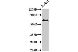Western Blot Positive WB detected in: Jurkat whole cell lysate All lanes: GNL1 antibody at 3. (GNL1 antibody  (AA 251-500))