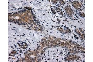 Immunohistochemical staining of paraffin-embedded breast tissue using anti-SIL1 mouse monoclonal antibody.