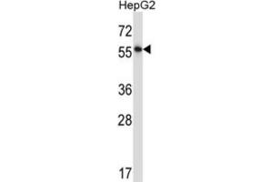 Western Blotting (WB) image for anti-Nuclear Factor I/A (NFIA) antibody (ABIN2997755) (NFIA antibody)