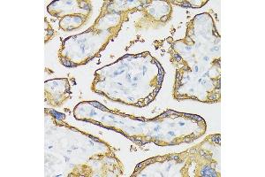 Immunohistochemistry of paraffin-embedded human placenta using Placental alkaline phosphatase (PLAP) antibody (ABIN6127420, ABIN6136826, ABIN6136827 and ABIN6221966) at dilution of 1:100 (40x lens). (PLAP antibody  (AA 260-460))