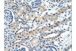 Image no. 1 for anti-Inhibin Binding Protein (INHBP) (AA 151-200) antibody (ABIN203489) (IGSF1 antibody  (AA 151-200))