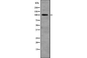 Western blot analysis of RALGDS expression in Liver (Human) Tissue Lysate ,The lane on the left is treated with the antigen-specific peptide.