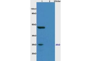 Lane 1: human colon carcinoma lysates Lane 2: rat brain lysates probed with Anti MYOG/Myogenin Polyclonal Antibody, Unconjugated (ABIN700660) at 1:200 in 4 °C. (Myogenin antibody)