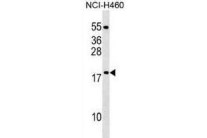 Western Blotting (WB) image for anti-Mitochondrial Ribosomal Protein L54 (MRPL54) antibody (ABIN2999653) (MRPL54 antibody)