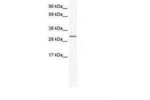 Image no. 1 for anti-Spi-C Transcription Factor (Spi-1/PU.1 Related) (SPIC) (N-Term) antibody (ABIN202113) (SPIC antibody  (N-Term))