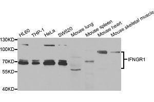Western blot analysis of extracts of various cell lines, using IFNGR1 antibody (ABIN5973372) at 1/1000 dilution. (IFNGR1 antibody)
