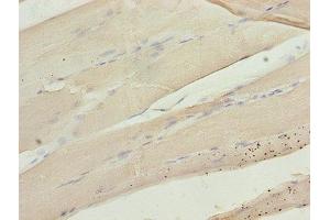 Immunohistochemistry of paraffin-embedded human skeletal muscle tissue using ABIN7146719 at dilution of 1:100