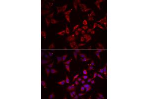 Immunofluorescence analysis of U2OS cells using NCR3 antibody (ABIN5974302). (NCR3 antibody)