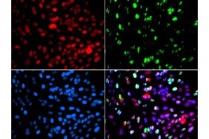 Immunofluorescence analysis of GFP-RNF168 transgenic U2OS cells using POLD3 antibody (ABIN5974362). (POLD3 antibody)