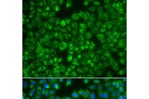 Immunofluorescence analysis of A549 cells using MTMR4 Polyclonal Antibody (MTMR4 antibody)