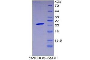 SDS-PAGE (SDS) image for Protease, serine, 1 (Trypsin 1) (PRSS1) (AA 51-228) protein (His tag) (ABIN1878318)