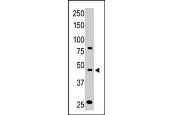CCBP2 antibody  (N-Term)
