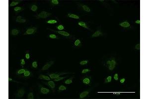 Immunofluorescence of monoclonal antibody to NHS on HeLa cell. (Nhs antibody  (AA 1532-1629))