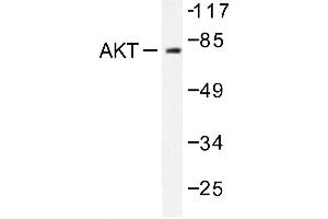 Image no. 1 for anti-V-Akt Murine Thymoma Viral Oncogene Homolog 1 (AKT1) antibody (ABIN271988) (AKT1 antibody)