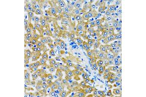Immunohistochemistry of paraffin-embedded rat liver using HD antibody (ABIN6133742, ABIN6141675, ABIN6141678 and ABIN6213911) at dilution of 1:100 (40x lens). (HDAC5 antibody  (AA 550-650))