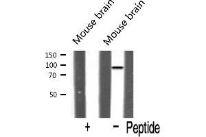 Western blot analysis of HSP105 expression in Mouse brain tissue lysate. (HSPH1 antibody  (C-Term))