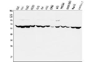 Western blot analysis of PIAS2 using anti-PIAS2 antibody (ABIN7602672).