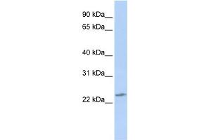 WB Suggested Anti-RBPMS2 Antibody Titration:  0. (RBPMS2 antibody  (Middle Region))