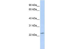 WB Suggested Anti-RBPMS2 Antibody Titration:  0.