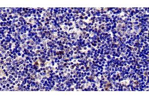 Immunohistochemistry (IHC) image for anti-Interleukin 2 Receptor, alpha (IL2RA) (AA 22-245) antibody (ABIN7443365)
