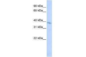 WB Suggested Anti-TMEM82 Antibody Titration:  0. (TMEM82 antibody  (N-Term))