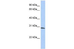 WB Suggested Anti-ZFYVE28 Antibody Titration:  0. (ZFYVE28 antibody  (N-Term))