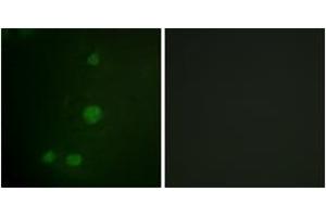 Immunofluorescence analysis of HuvEc cells, using Retinoblastoma (Ab-811) Antibody. (Retinoblastoma Protein (Rb) antibody  (AA 771-820))