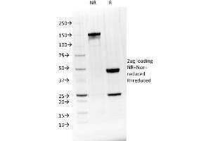 SDS-PAGE Analysis Purified BTLA Mouse Monoclonal Antibody (BTLA/1528). (BTLA antibody)