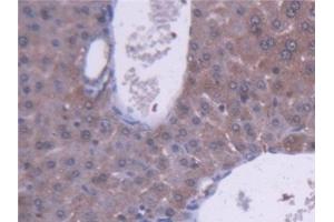 Detection of ALDH1A1 in Mouse Liver Tissue using Polyclonal Antibody to Aldehyde Dehydrogenase 1 Family, Member A1 (ALDH1A1) (ALDH1A1 antibody  (AA 1-326))