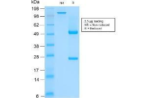 SDS-PAGE Analysis of Purified CK HMW Mouse Recombinant Monoclonal Antibody (rKRTH/2148). (Recombinant Cytokeratin 2 antibody)