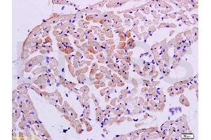 Formalin-fixed and paraffin embedded rat heart tissue labeled with Anti-STAT2 Polyclonal Antibody, Unconjugated (ABIN738246) at 1:200 followed by conjugation to the secondary antibody and DAB staining (STAT2 antibody  (AA 151-250))