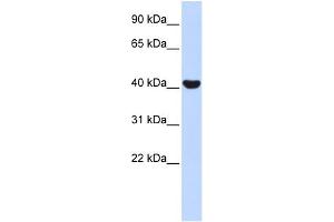 Western Blotting (WB) image for anti-Nuclear Receptor Subfamily 2, Group E, Member 1 (NR2E1) (N-Term) antibody (ABIN2779454)