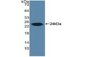 Detection of Recombinant ARO, Human using Polyclonal Antibody to Aromatase (ARO) (Aromatase antibody  (AA 196-373))