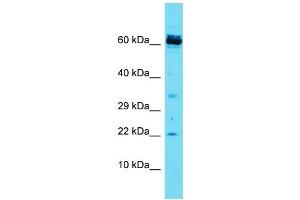 Host: Rabbit Target Name: CCDC115 Sample Type: Jurkat Whole Cell lysates Antibody Dilution: 1. (CCDC115 antibody  (N-Term))