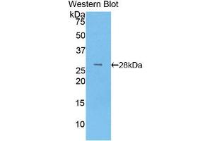 Western blot analysis of the recombinant protein. (LOXL3 antibody  (AA 519-726))