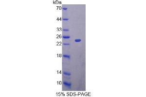SDS-PAGE analysis of Rat MRPL1 Protein.