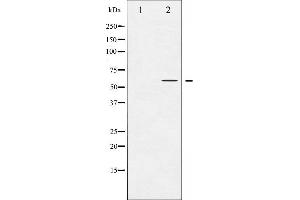 Western blot analysis of Akt phosphorylation expression in Mouse brain tissue lysates,The lane on the left is treated with the antigen-specific peptide. (AKT1 antibody  (pSer124))