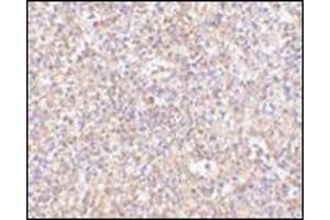 Immunohistochemistry of STEAP1 in human spleen tissue AP30832PU-N antibody at 2. (STEAP1 antibody  (C-Term))