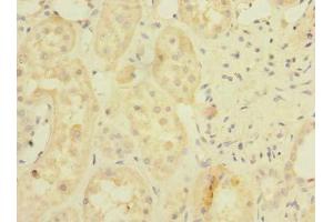 Immunohistochemistry of paraffin-embedded human kidney tissue using ABIN7142304 at dilution of 1:100 (BDH2 antibody  (AA 1-245))