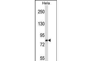 TRIM37 Antibody (C-term) (ABIN657211 and ABIN2846321) western blot analysis in Hela cell line lysates (35 μg/lane). (TRIM37 antibody  (C-Term))