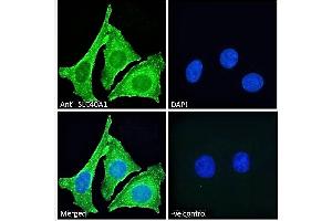 ABIN2613478 Immunofluorescence analysis of paraformaldehyde fixed HeLa cells, permeabilized with 0. (SLC40A1 antibody  (AA 245-259))