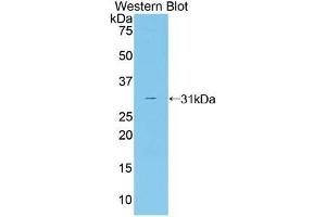 Western blot analysis of the recombinant protein. (CNTF Receptor alpha antibody  (AA 120-358))