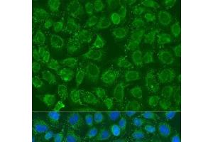 Immunofluorescence analysis of U2OS cells using PIP5K1B Polyclonal Antibody at dilution of 1:100. (PIP5K1B antibody)