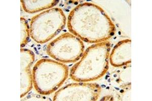 IHC analysis of FFPE human lung with Caspase-2 antibody (Caspase 2 antibody  (AA 198-226))
