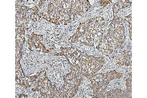 IHC analysis of HSPD1 using anti-HSPD1 antibody (ABIN7600976). (HSPD1 antibody  (AA 260-496))