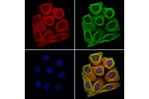 ABIN6260014 and ABIN6279139 staining Hela cells by IF/ICC. (AQP9 antibody  (Internal Region))